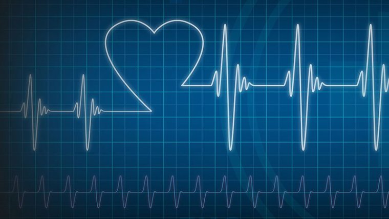 monitoring-accouchement